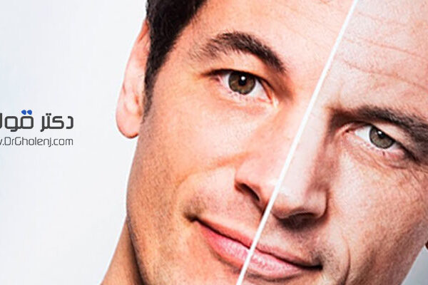 بهترین فیزیوتراپی دراصفهان دکتر قولنج