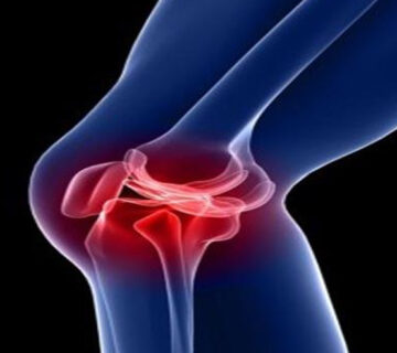 آب-آوردن-زانو