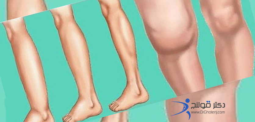 بهترین فیزیوتراپی دراصفهان دکتر قولنج