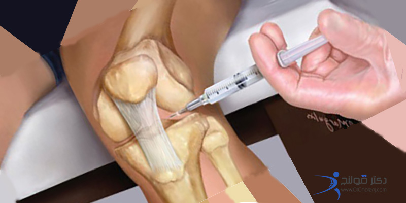 بهترین فیزیوتراپی دراصفهان دکتر قولنج