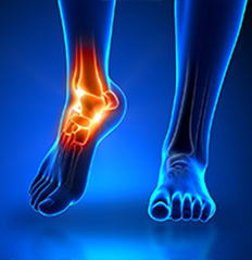 بهترین فیزیوتراپی دراصفهان