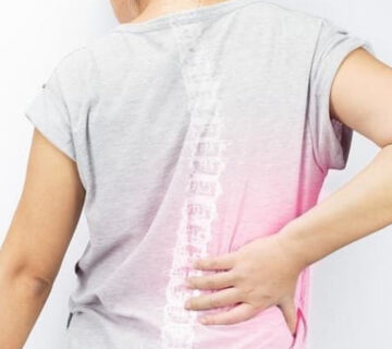 درمان-شکستگی-مهره