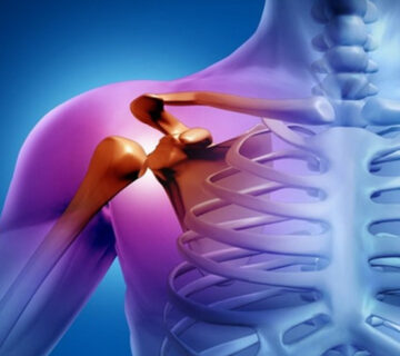 شانه-یخ-زده