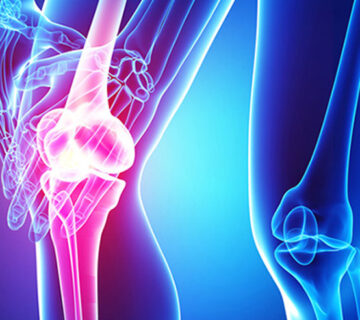 پارگی-رباط-صلیبی