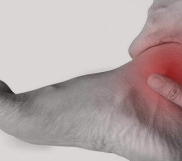 پیچیدگی-مچ-پا