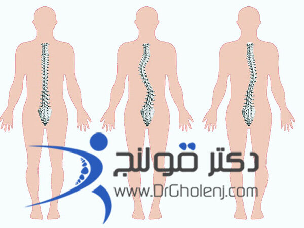 بهترین فیزیوتراپی در اصفهان دکتر قولنج