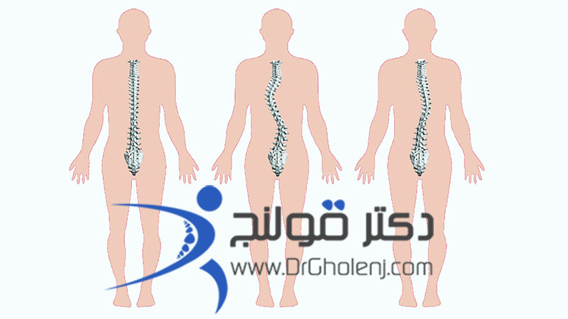 بهترین فیزیوتراپی در اصفهان دکتر قولنج