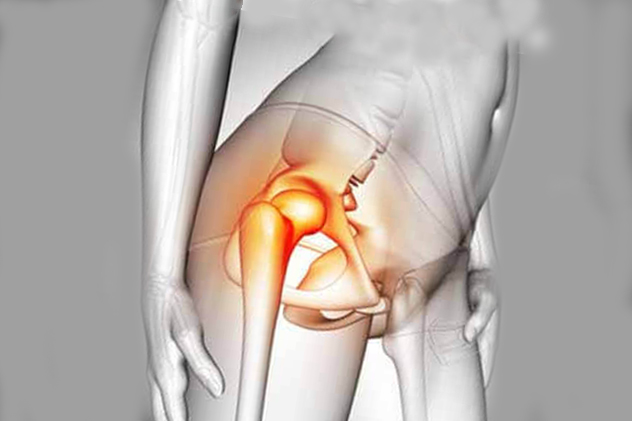 درد در کشاله ران drgholenj