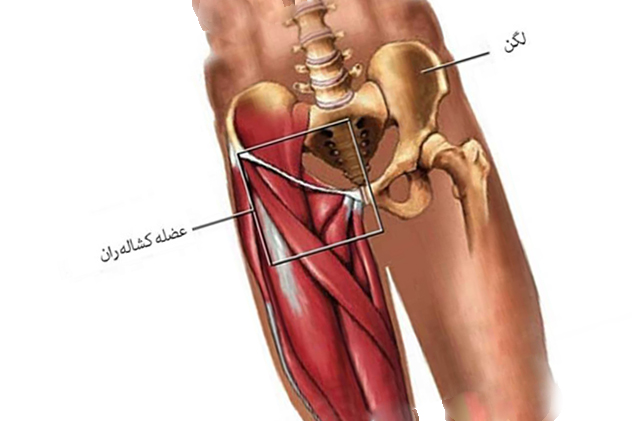 درد در کشاله ران drgholenj