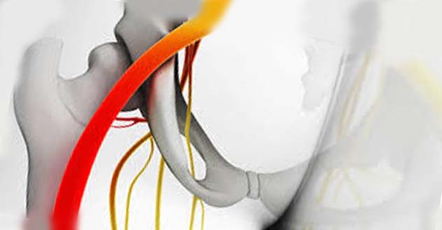 درد در کشاله ران drgholenj