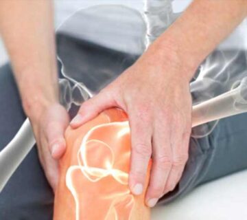 پوکی-استخوان بهترین فیزیوتراپی دراصفهان