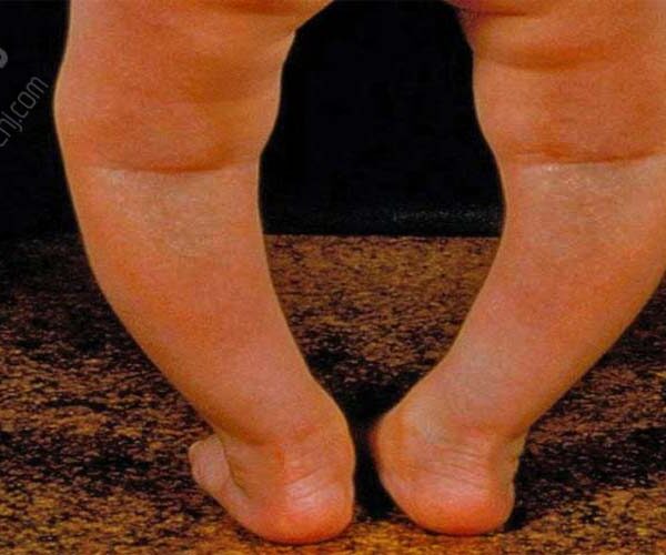 فیزیوتراپی دراصفهان دکتر قولنجdrgholenj