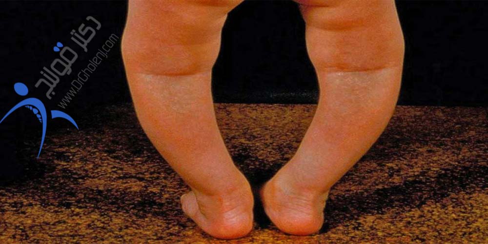 فیزیوتراپی دراصفهان دکتر قولنجdrgholenj