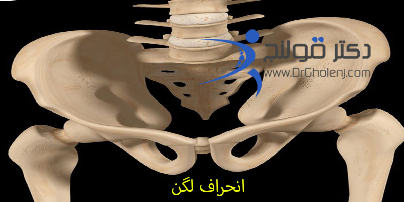 فیزیوتراپی دراصفهان دکتر قولنج