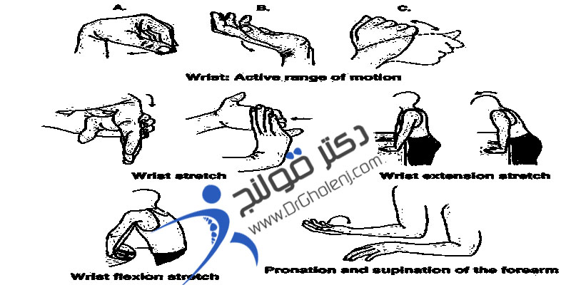 کشیدگی رباط مچ دست دکتر قولنج