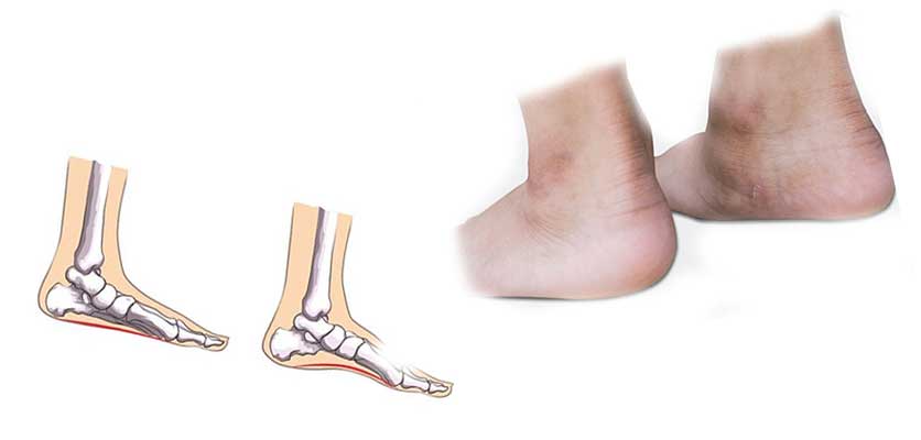 فیزیوتراپی دراصفهان دکتر قولنج