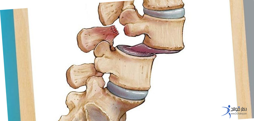 بهترین فیزیوتراپی در اصفهان