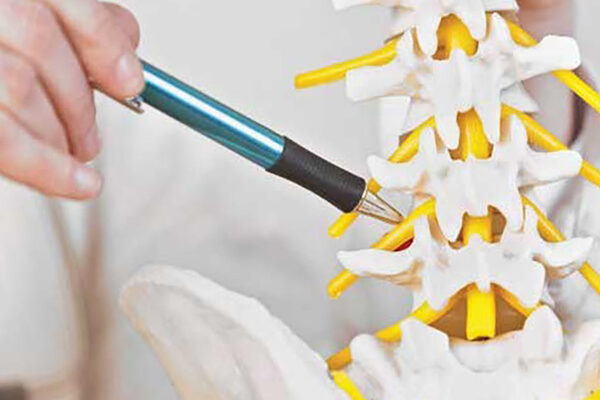 تنگی کانال نخاع