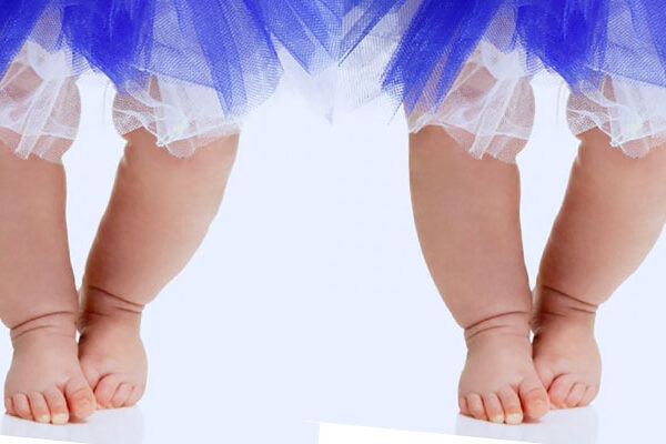 زانوی پرانتزی