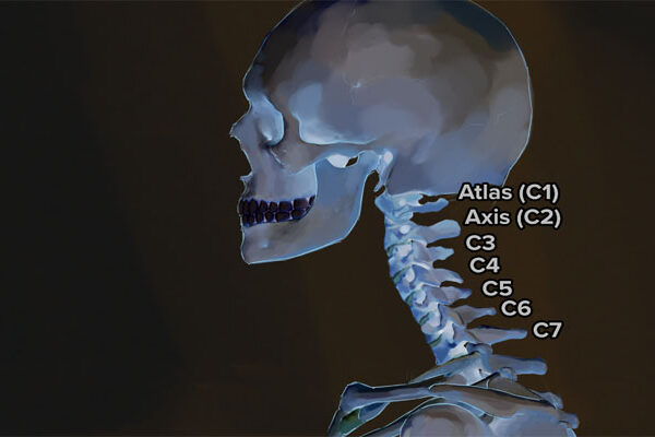 بهترین فیزیوتراپی در اصفهان | فیزیوتراپی آرتروز گردن در اصفهان