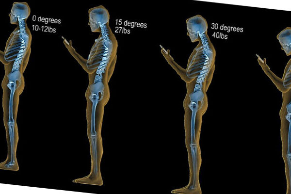 بهترین فیزیوتراپی در اصفهان | فیزیوتراپی دراصفهان