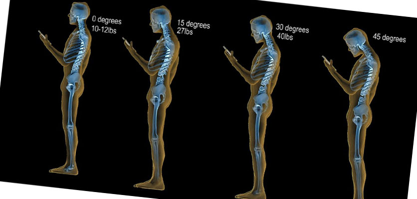 بهترین فیزیوتراپی در اصفهان | فیزیوتراپی دراصفهان