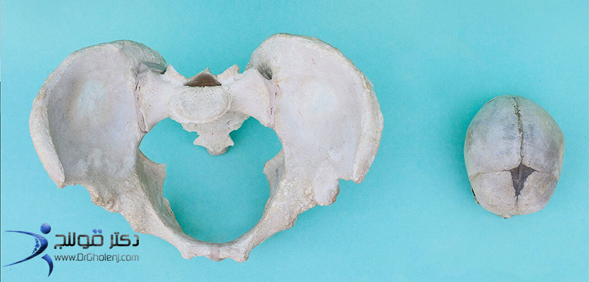 بهترین فیزیوتراپی دراصفهان | فیزیوتراپی بورسیت لگن دراصفهان