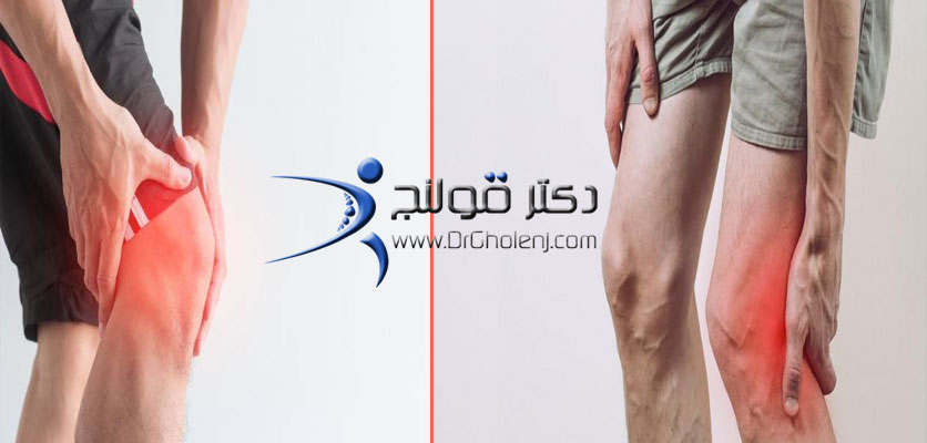 بهترین فیزیوتراپی دراصفهان | فیزیوتراپی پارگی مینیسک زانو دراصفهان