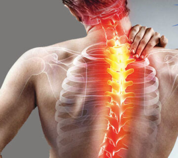 بهترین فیزیوتراپی دراصفهان | فیزیوتراپی اسکولیوز دراصفهان