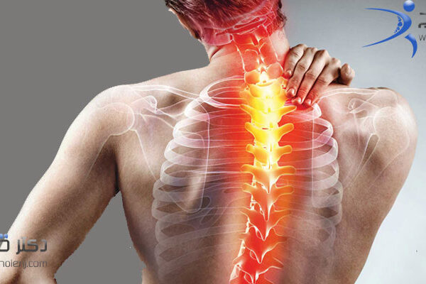 بهترین فیزیوتراپی دراصفهان | فیزیوتراپی اسکولیوز دراصفهان