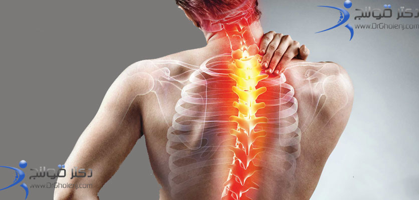 بهترین فیزیوتراپی دراصفهان | فیزیوتراپی اسکولیوز دراصفهان