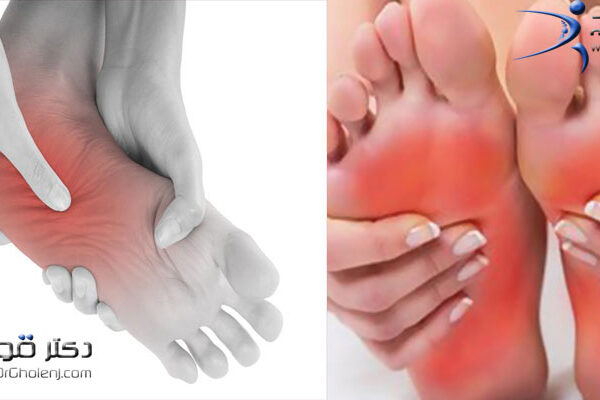 بهترین فیزیوتراپی دراصفهان | فیزیوتراپی درد کف پا دراصفهان