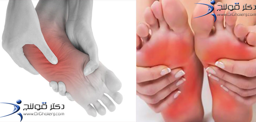 بهترین فیزیوتراپی دراصفهان | فیزیوتراپی درد کف پا دراصفهان