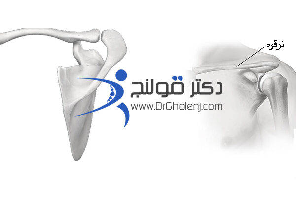 بهترین فیزیوتراپی در اصفهان - فیزیوتراپی شانه تمرینات و بیماری ها مانند ارتروز شانه