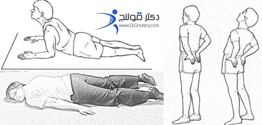 ورزش مکنزي براي کمر - دکتر قولنج