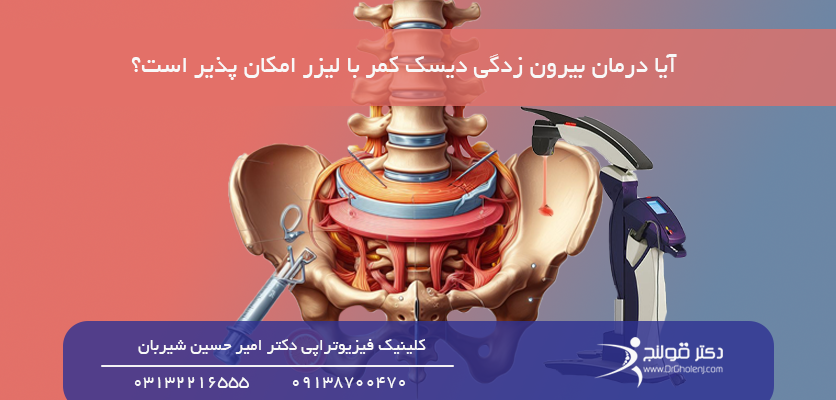 دیسک کمر _ درمان بیرون زدگی دیسک کمر با لیزر