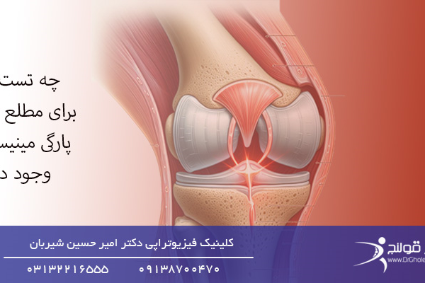 مطلع شدن از پارگی مینیسک زانو-تست پارگی مینیسک زانو- دکتر قلنج-Drgholenjمطلع شدن از پارگی مینیسک زانو-تست پارگی مینیسک زانو