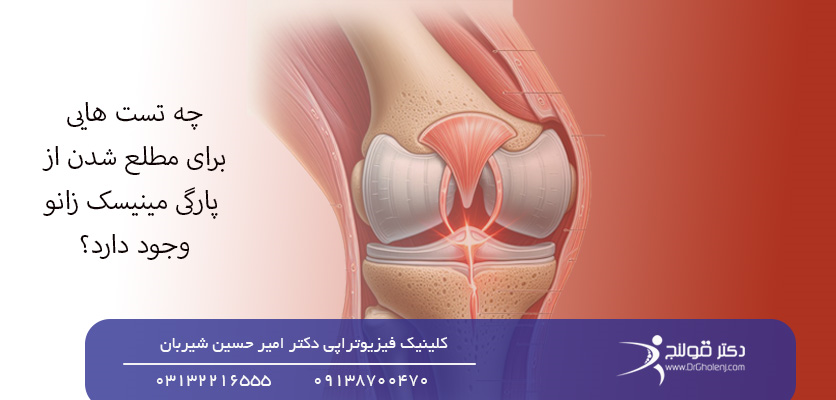 مطلع شدن از پارگی مینیسک زانو-تست پارگی مینیسک زانو- دکتر قلنج-Drgholenjمطلع شدن از پارگی مینیسک زانو-تست پارگی مینیسک زانو